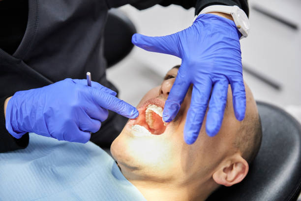 Best Emergency Tooth Extraction in Mendon, IL
